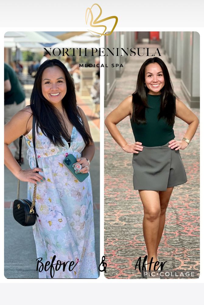 North Peninsula Medical Spa Logo